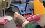 Ученые назвали самые опасные сопутствующие коронавирусу заболевания