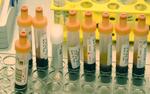 В Техасе и Калифорнии резко выросло число заражений COVID-19
