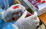Во Владимирской области количество случаев заражения COVID-19 превысило 4,3 тысячи