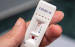 Кожный тест позволит определить необходимость ревакцинации от COVID