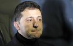 Зеленский остался недоволен работой МАГАТЭ на ЗАЭС