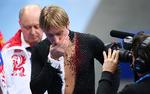 Состояние здоровья Плющенко стало притчей во языцех