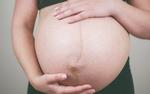 Девочка, пострадавшая от вируса Зика, родилась в США