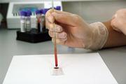 Новый метод анализа крови поможет диагностировать рак