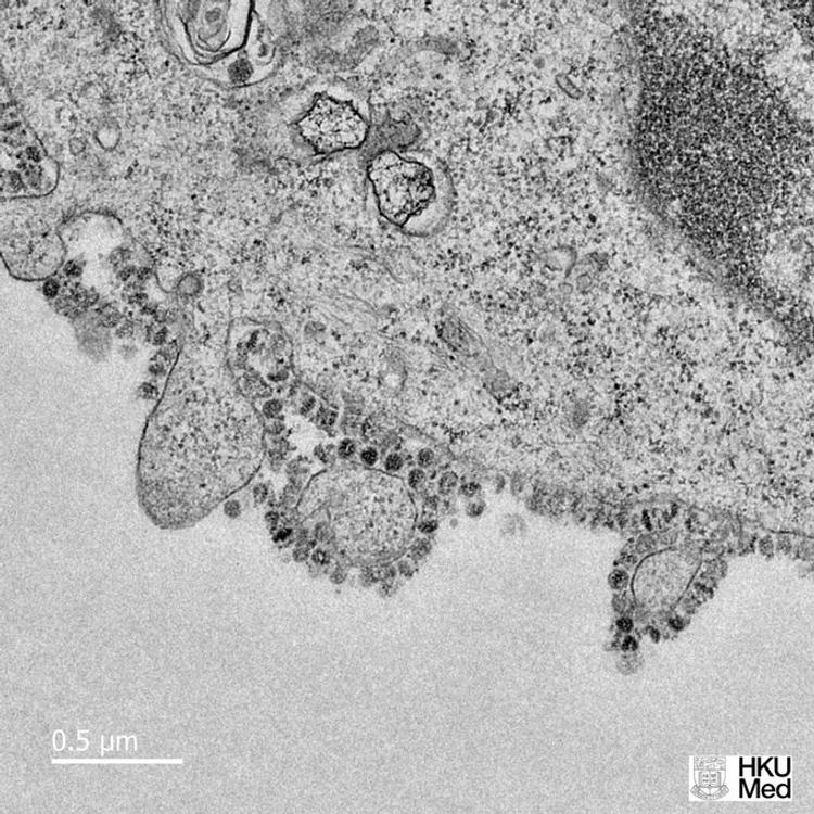 Китайские ученые опубликовали в Интернете  первые снимки размножения коронавируса 