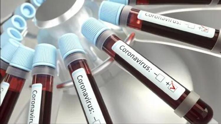 Следственный комитет Москвы начал проверку из-за фейков о коронавирусе