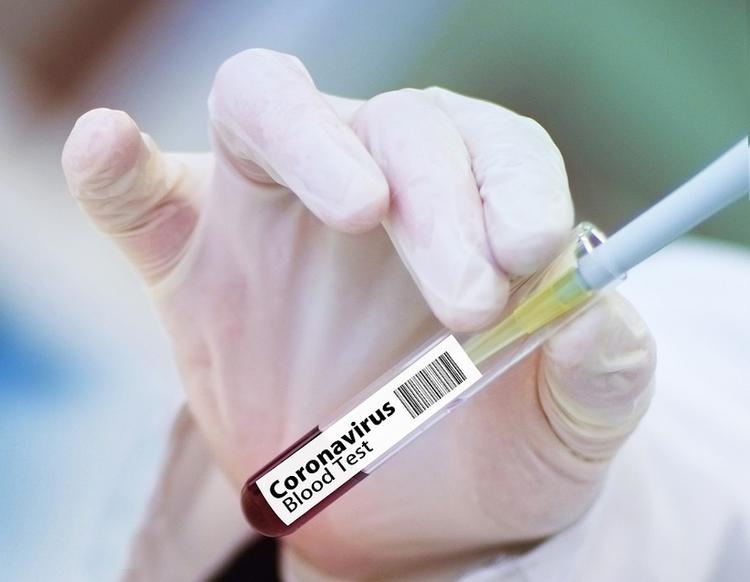 В Иране коронавирусом заболели более 21 тысячи человек
