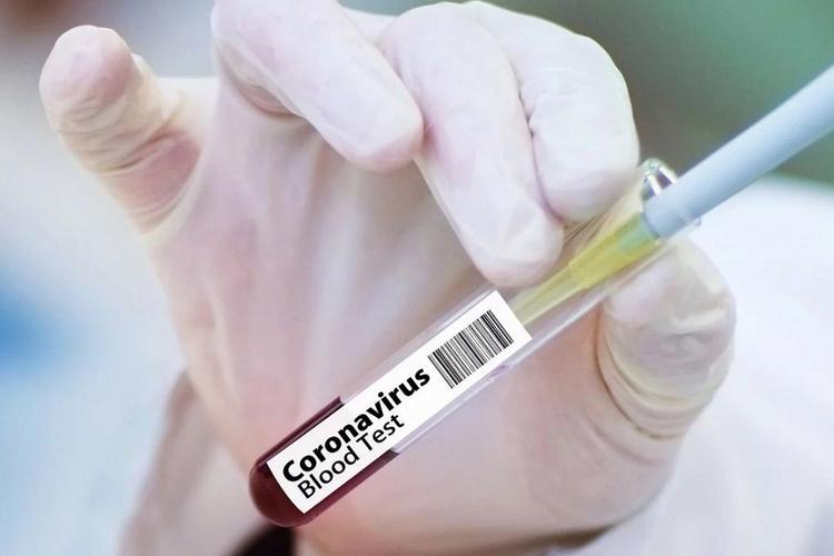 В Челябинской области выявлен новый случай заражения коронавирусом