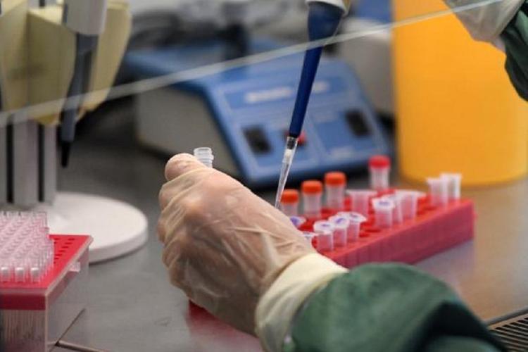 В России зарегистрировали тест-систему на антитела к коронавирусу 