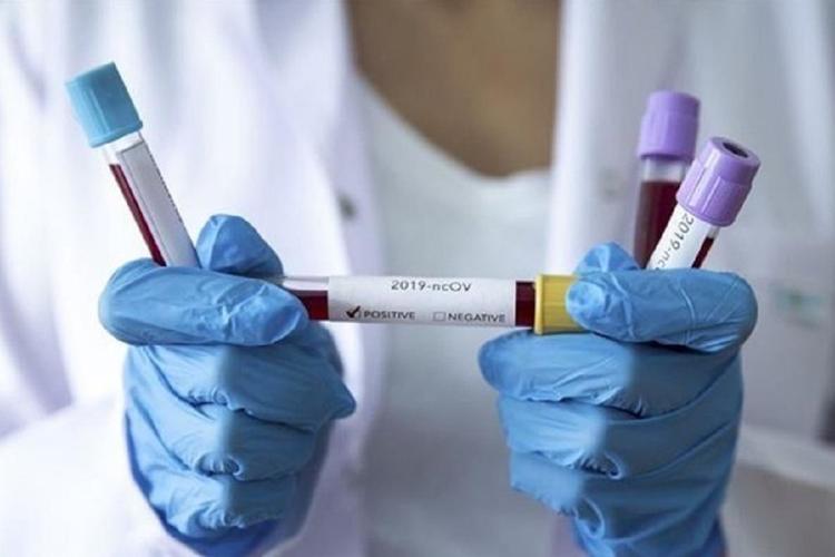 В Удмуртии два человека умерли от коронавирусной инфекции