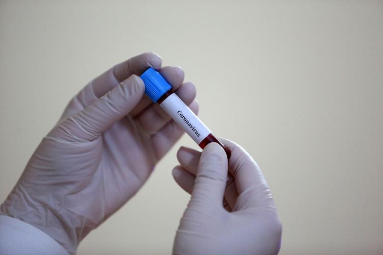 Три новых случая коронавируса выявлены в Новосибирской области