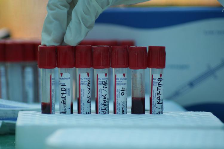 В Ростовской области скончался первый пациент с коронавирусом нового типа