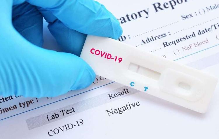 Медработников в Москве проверяют экспресс-тестами на иммунитет к COVID-19