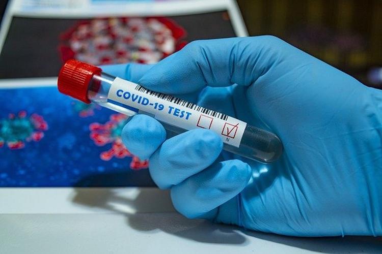 Число заразившихся коронавирусом в мире превысило три миллиона человек