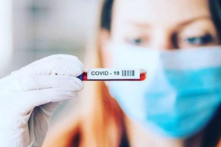 В Чувашии число заболевших коронавирусом перевалило за 600