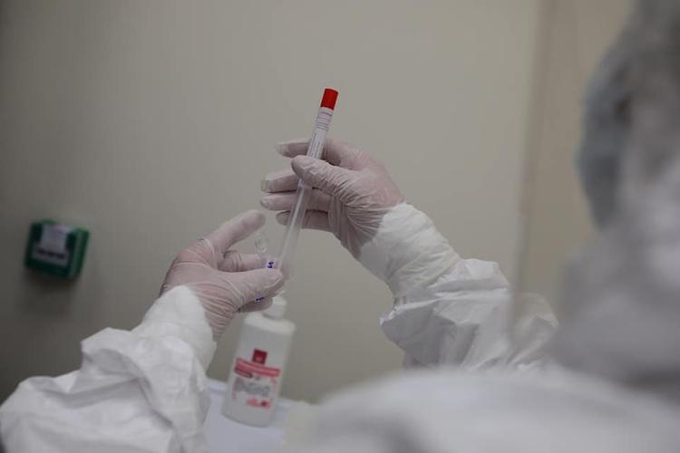 В Челябинской области скончались два человека с коронавирусом