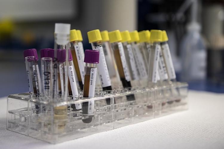 Таиланд зафиксировал три новых случая заражения коронавирусом за сутки
