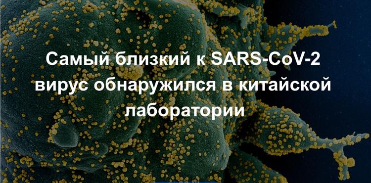 В лаборатории Уханя нашли самый близкий к SARS-CoV-2 вирус 