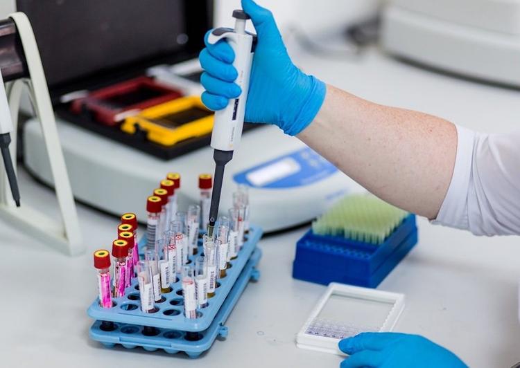 Депутат МГД: Тест на антитела к COVID-19 позволит выявить пациентов с легкой и средней степенью болезни