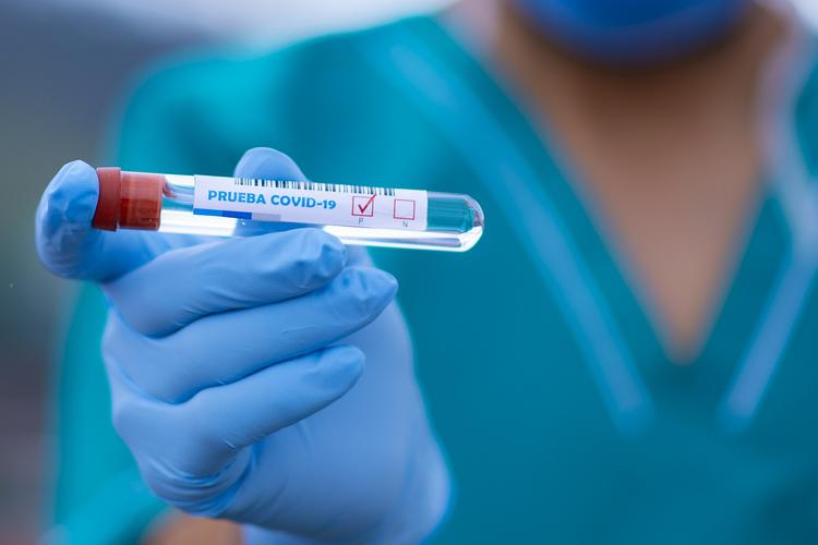 За минувшие сутки в Карелии подтверждено 15 новых случаев коронавируса