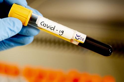 За сутки в России скончались 182 человека с коронавирусом