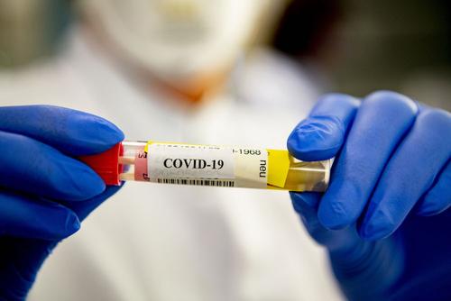 За сутки в России скончались 134 человека с коронавирусом