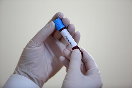 В Нижегородской области число случаев заражения коронавирусом превысило 12 тысяч