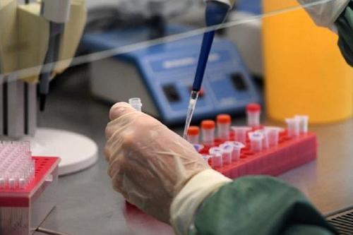 В ВОЗ не смогли объяснить низкую смертность от коронавируса в России