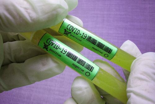 В России за сутки зарегистрировали 8 987 случаев заражения коронавирусом