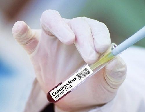 Количество заразившихся COVID-19 в мире превысило 8 миллионов
