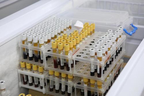 Количество жертв коронавируса нового типа в мире превысило 473 тысячи человек
