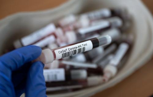 В России за сутки выявили 5 394 случая заражения коронавирусом