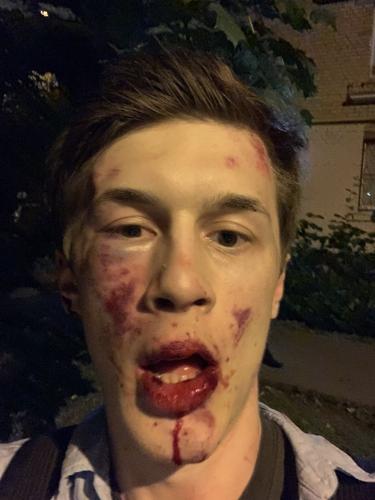 На Егора Жукова напали и избили около его дома
