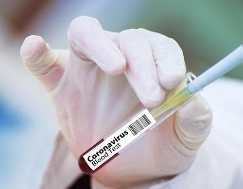 Китайская вакцина от COVID-19 может появиться в продаже к концу 2020 года