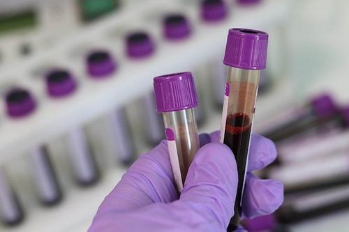 Вирусолог Нетесов заявил, что течение COVID-19 связано с группой крови