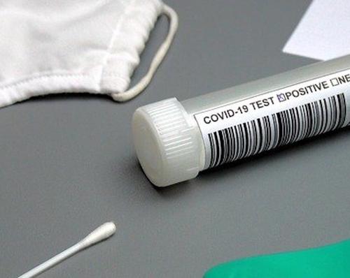 В США позволили использовать первый тест на коронавирус в домашних условиях