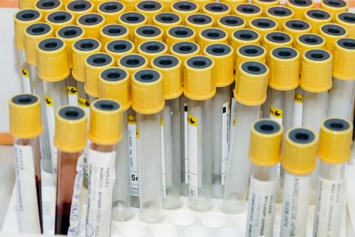 За сутки в России скончались 454 пациента с коронавирусом