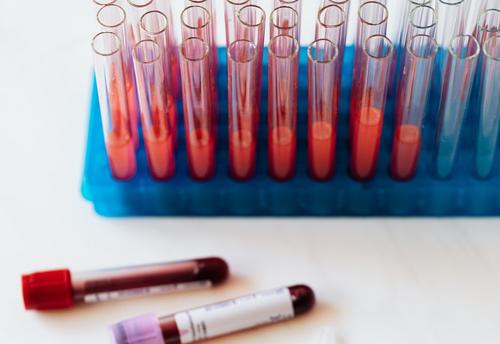  Шведские ученые нашли связь между серьезными заболеваниями и группой крови