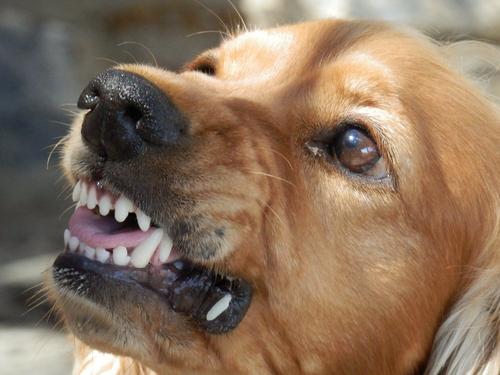 В Мурманске стая собак напала на девочку: зафиксировано более 100 укусов
