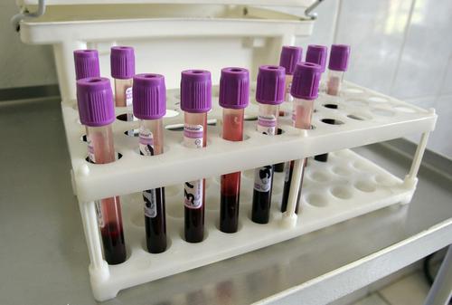 Биолог Анча Баранова: люди со второй и четвертой группами крови имеют больше шансов заболеть COVID-19