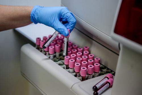 В России зарегистрирована тест-система для выявления штамма коронавируса «омикрон»
