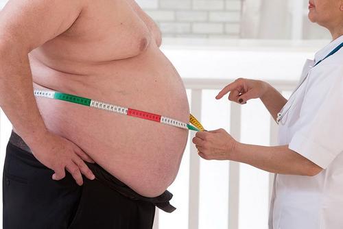 Лечение ожирения могут включить в ОМС