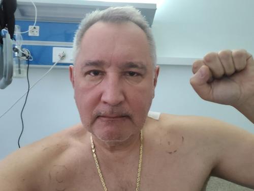 Рогозин перенес операцию и опубликовал первое фото после извлечения осколка