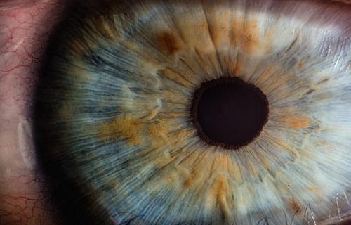 Офтальмолог Петров рассказал, что глаукома все чаще бывает не только у пожилых