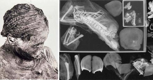 Археологи обследовали мумию, которая умерла при родах более 1500 лет назад