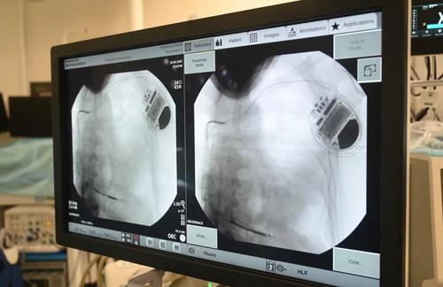 Анастасия Ракова рассказала о технологии, помогающей предотвратить внезапную смерть при болезнях сердца в Москве Анастасия Ракова рассказала о технологии, помогающей предотвратить внезапную смерть при болезнях сердца в Москве