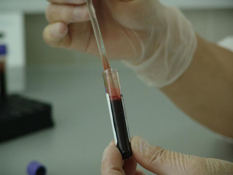Сделано революционное открытие: на сексуальную ориентацию влияет группа крови