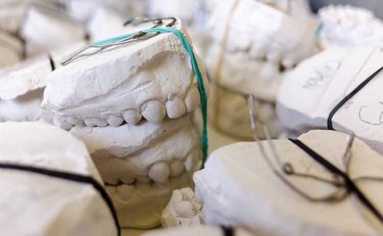 Ученые изобрели антибактериальные зубные импланты и распечатали их на принтере