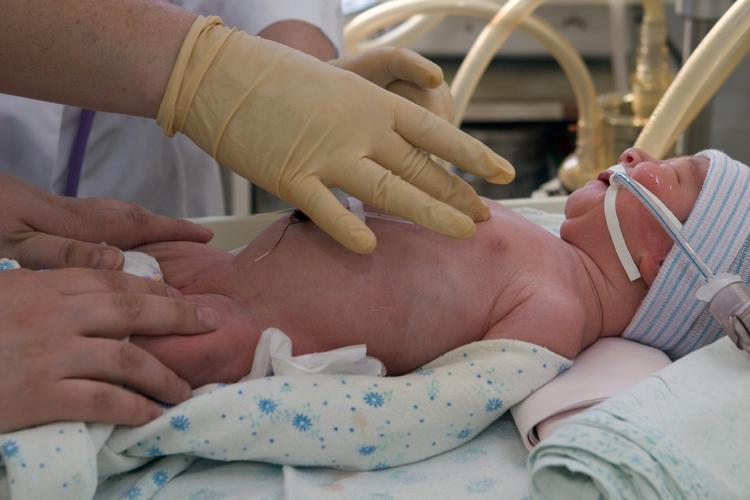 В Польше произошло чудо: через 55 дней после смерти матери родился ребенок