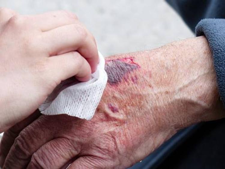 Осужденный паралимпиец Писториус попал в больницу с ранами на запястьях